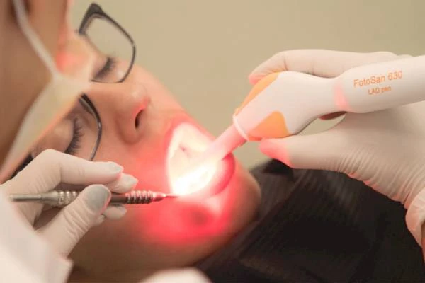 Parodontologija | DentalCore - DentalCore